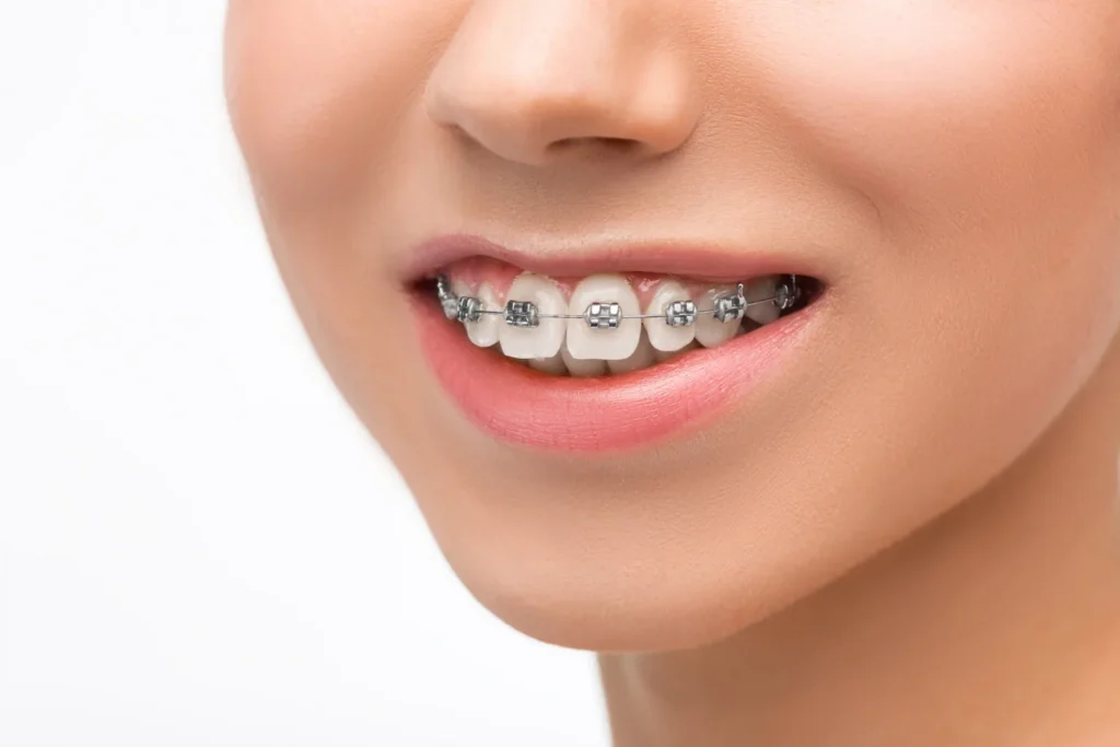 Best Orthodontist Doctors in Koregaon Park, Pune