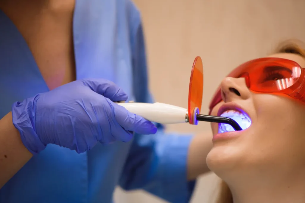 Teeth Cleaning & Polishing
