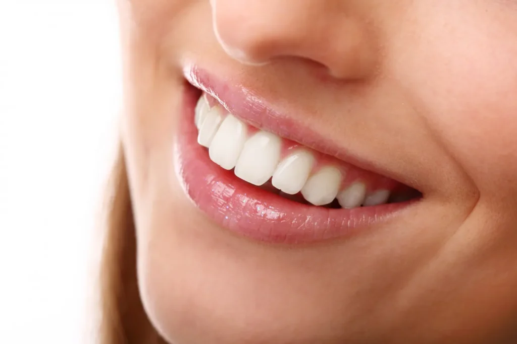 Instant Teeth Whitening in Pune