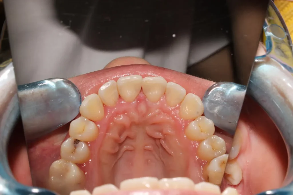Prosthodontist in Koregaon Park Pune