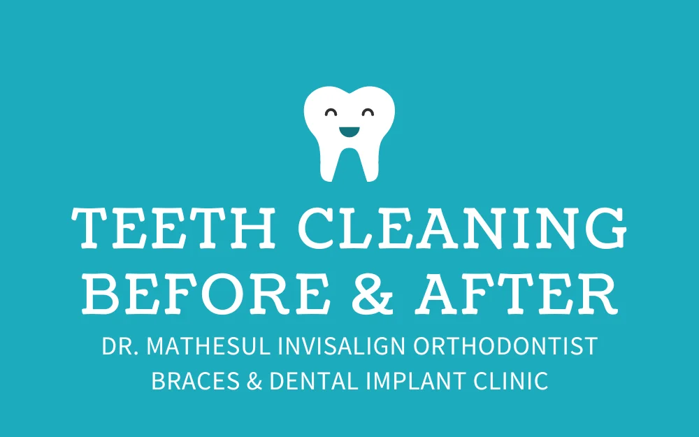 Teeth Cleaning Before and After