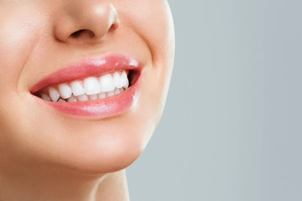 Teeth Whitening Service In Koregaon Park, Pune