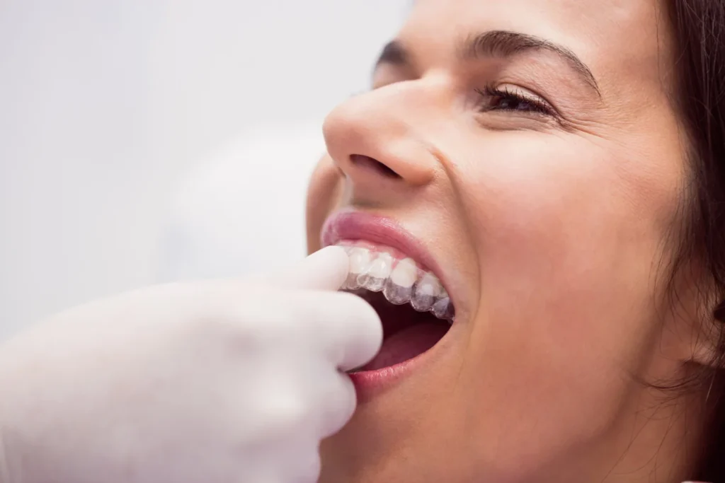 Transform your smile comfortably with Invisalign in Kalyani Nagar