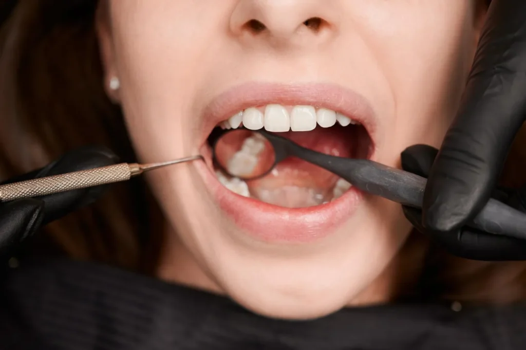 What Can I Expect Before My Treatment