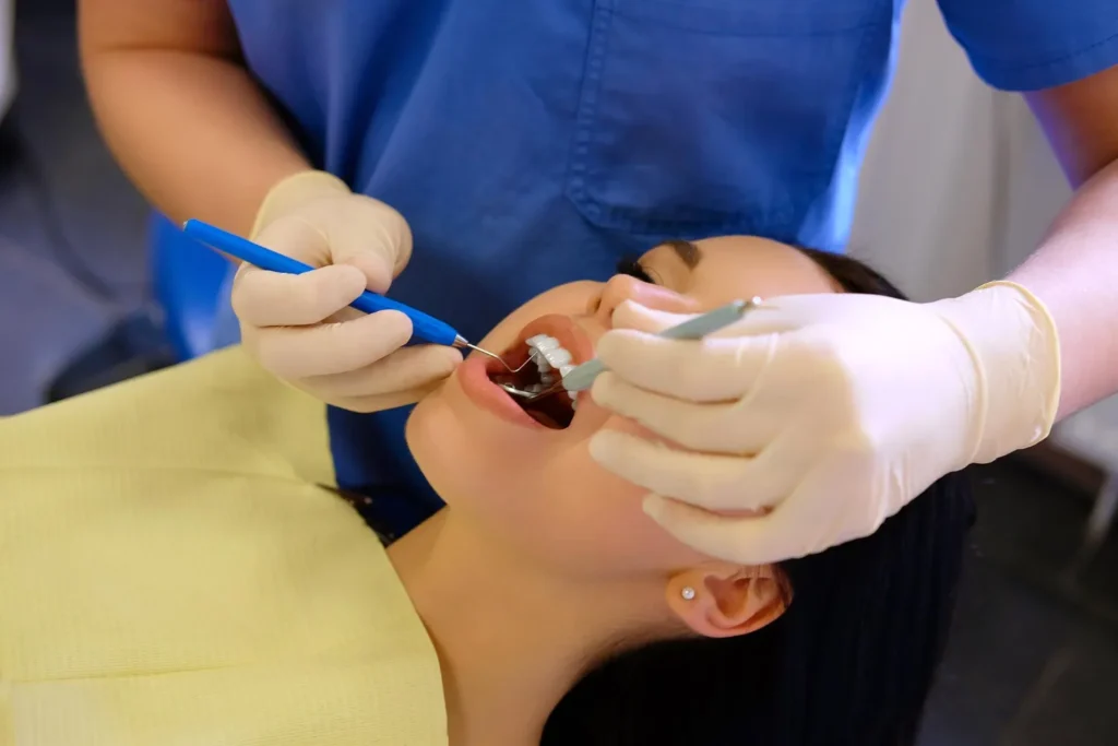 Wisdom Tooth Removal