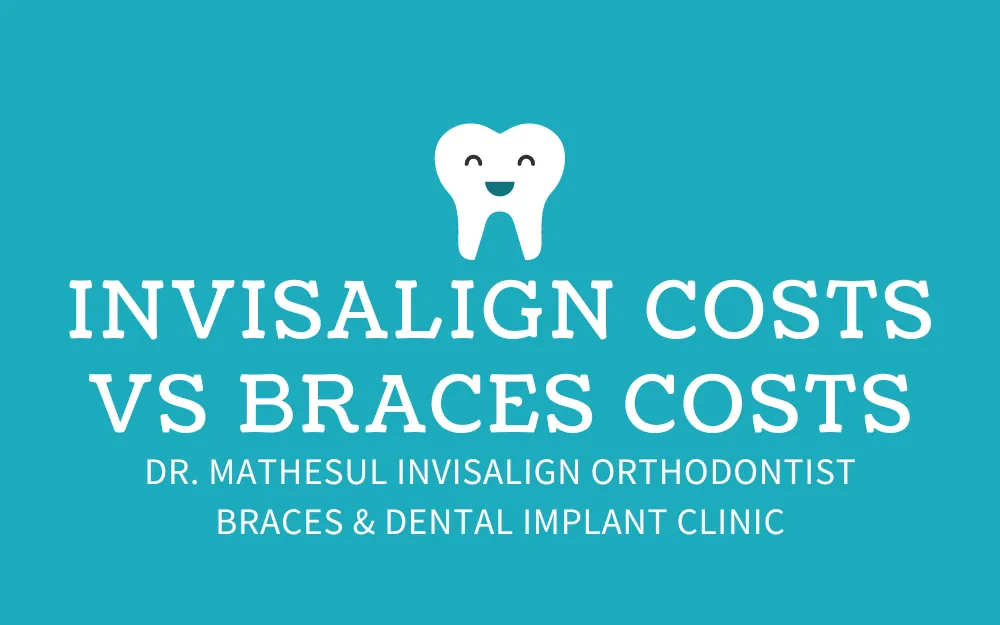 Invisalign Costs vs Braces Costs