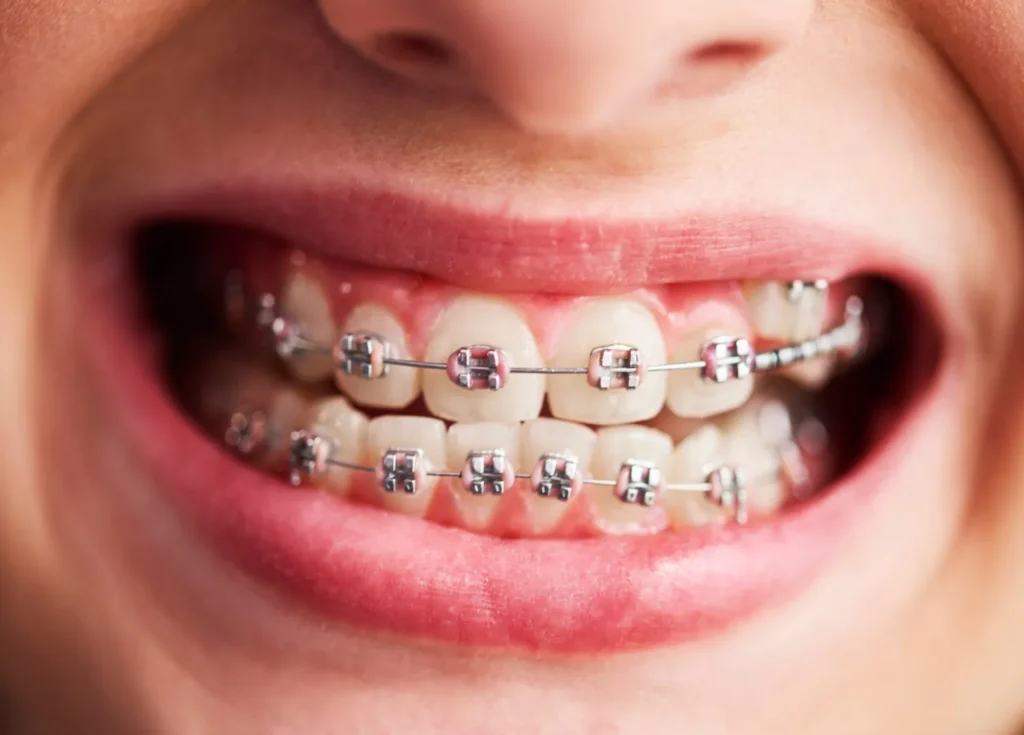 Orthodontist
