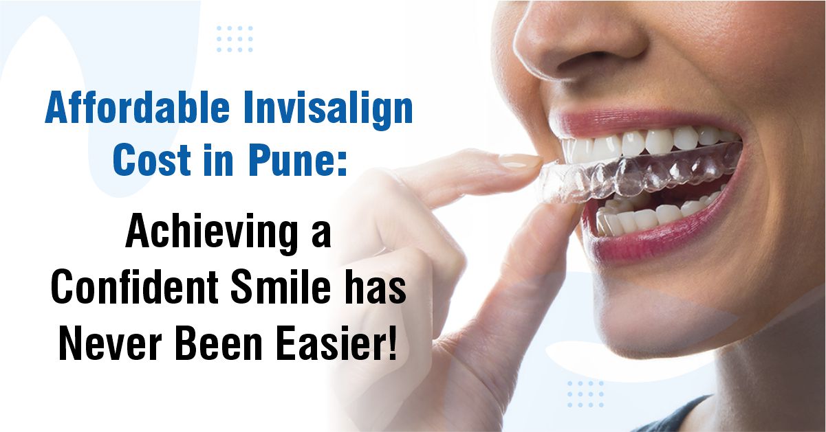 Affordable Invisalign Cost in Pune