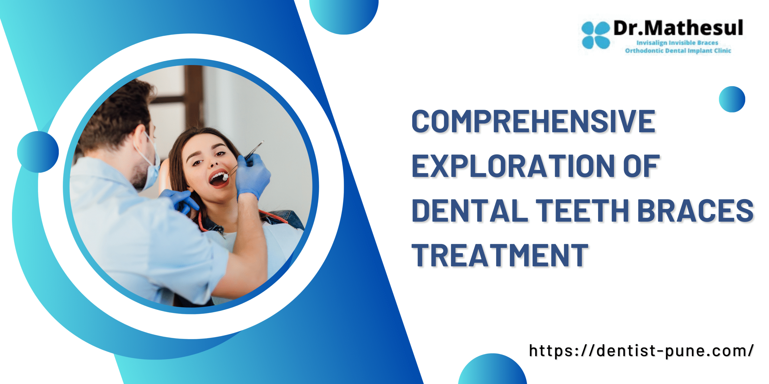 dental teeth braces treatment