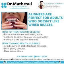 Orthodontist Near Me in Viman Nagar Pune